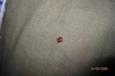 ​以人类血液为食！多国爆发床虱危机，“犹如噩梦”！已蔓延至亚洲