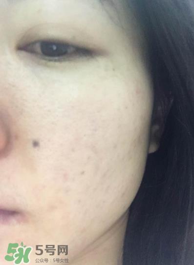 赫莲娜悦活蓄能新肌水怎么样 绿宝瓶蓄能新肌水好用吗