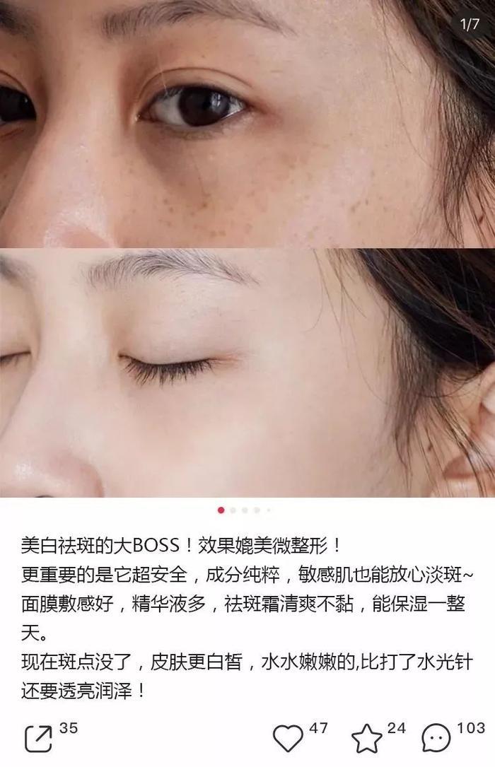 28天“色斑”全没了！她们都在这样做，网友惊呼：太神奇了！