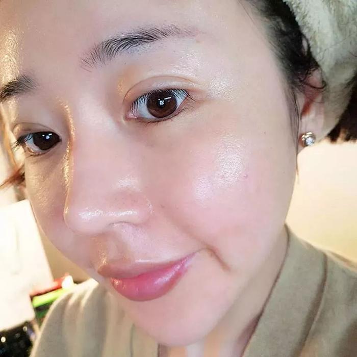 28天“色斑”全没了！她们都在这样做，网友惊呼：太神奇了！