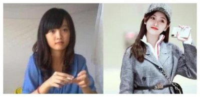 ​艺人前VS后，包装的效果堪比整容，网友：进的是“整容”公司？