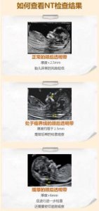 ​关于“nt”成为新网络用语的探讨：为何我们应谨慎使用？