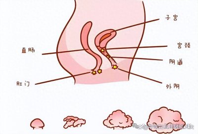 ​医生大实话：女人有没有感染HPV，看这几点就够了！