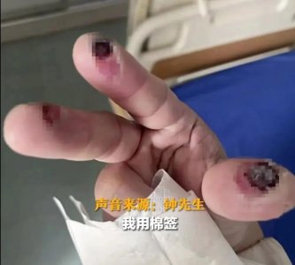 ​警惕清洁剂中隐藏的“化骨水”！你家可能也有