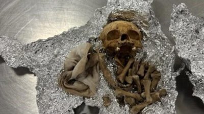 ​美国机场海关在一乘客行李中查获人类头骨，乘客：是用于举办仪式