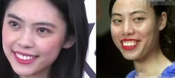 《功夫》龅牙珍生活照曝光,撞脸王祖贤!网友:被星爷骗了