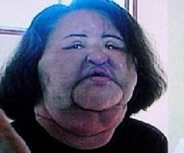 ​韩苗可整容前后的样子对比 那个超级失败的案例