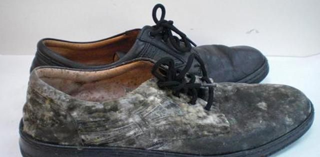 洗的鞋子为什么会发黄